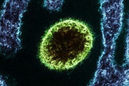 Foto: Reprodução/ Instituto Nacional de Alergia e Doenças Infecciosas dos EUA