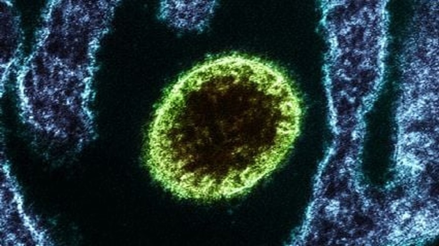 Vírus Nipah pode chegar ao Brasil? veja