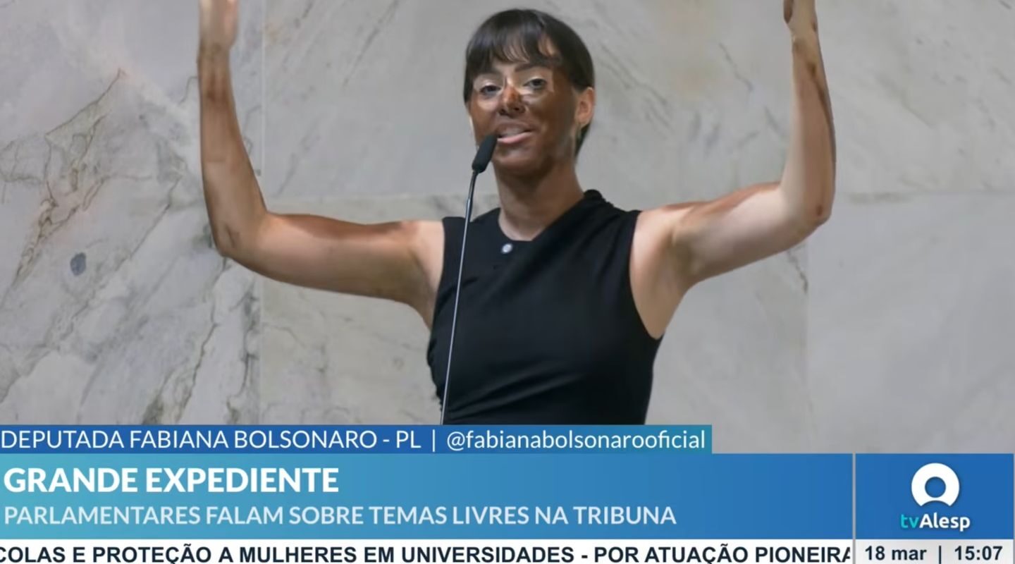 Deputada do PL faz blackface na Alesp para criticar Erika Hilton