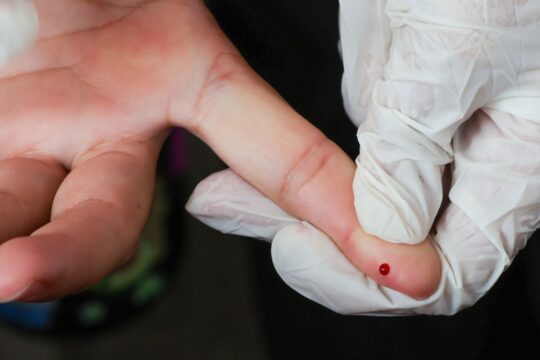 SUS passa a oferecer teste rápido de dengue