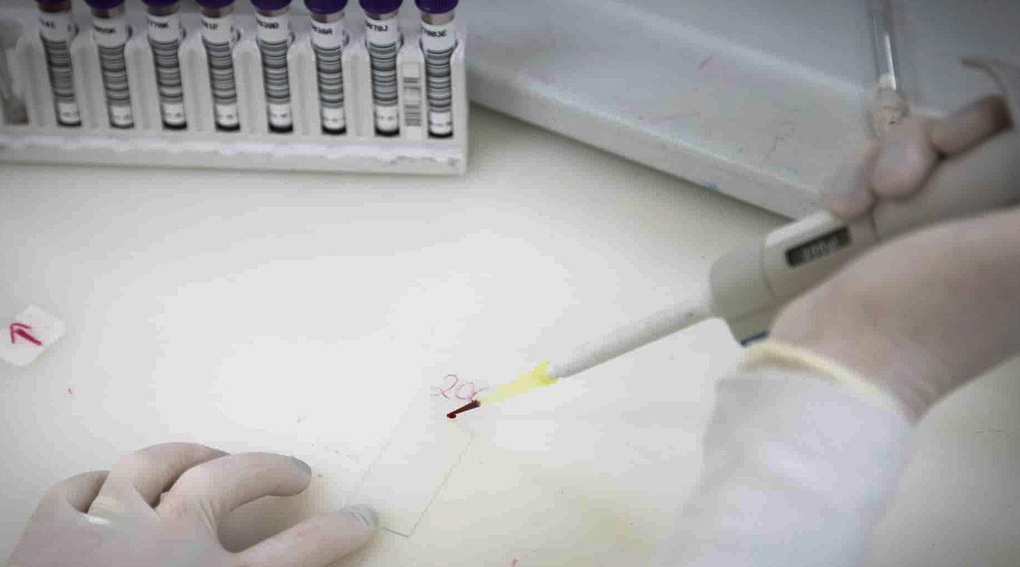 Secretaria de Saúde de SP investiga novo caso suspeito de ebola