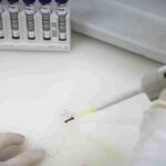 Paciente em SP com suspeita de ebola testa positivo para meningite