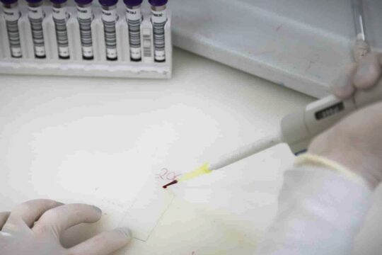 Paciente em SP com suspeita de ebola testa positivo para meningite