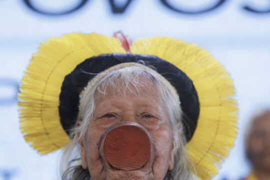 Cacique Raoni tem hemorragia digestiva, mas quadro é estável