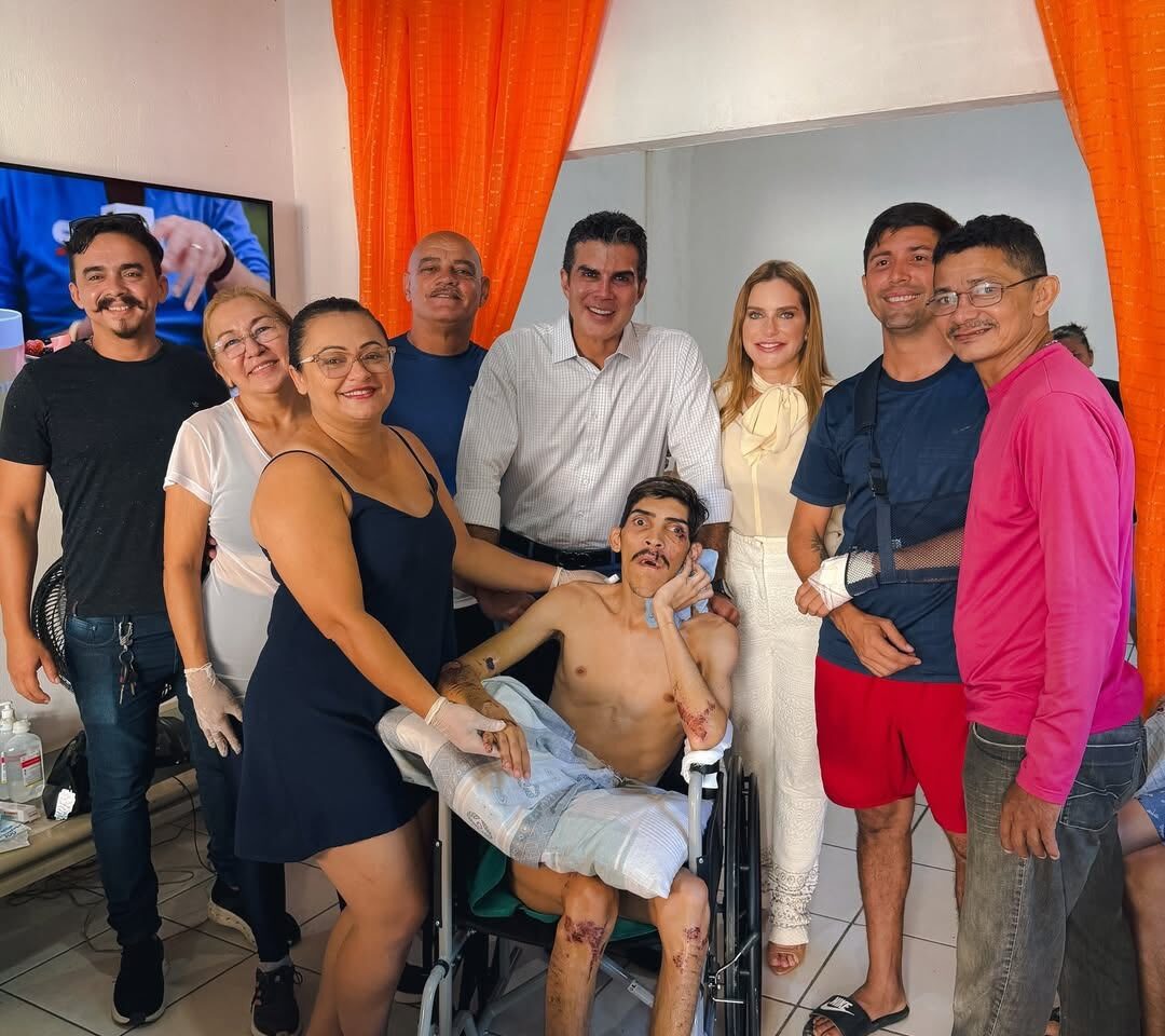 Helder e Daniela Barbalho visitam Pampam durante recuperação após atropelamento em Belém