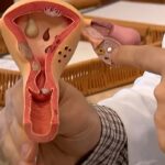 Aberta chamada pública para pesquisas sobre endometriose