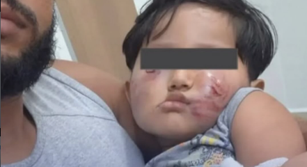 Criança de 2 anos é agredida no rosto dentro de creche particular, em Belém